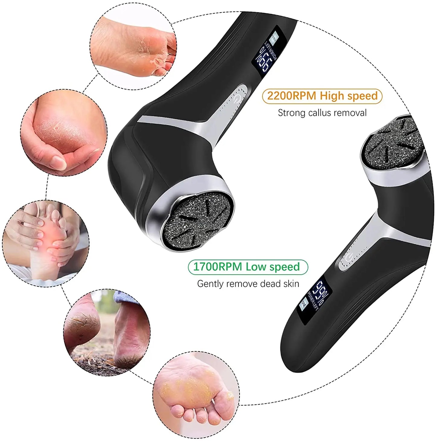 Rimuovi Calli Elettrico Professionale – Pedicure Piedi Levigatore Pelle Dura