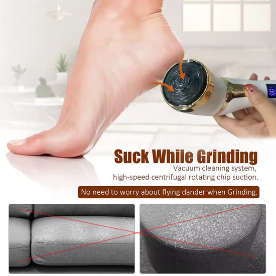 Rimuovi Calli Elettrico Professionale – Pedicure Piedi Levigatore Pelle Dura